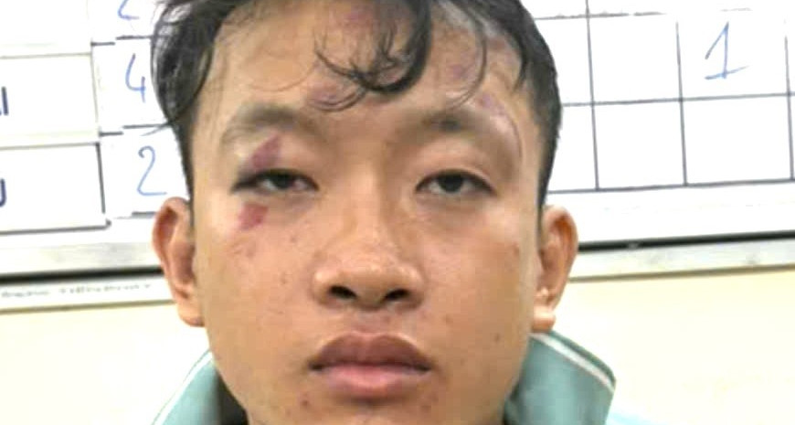 Ke Giet Nu Chu Tiem Tap Hoa Khai Gi Voi Co Quan Cong An 56807